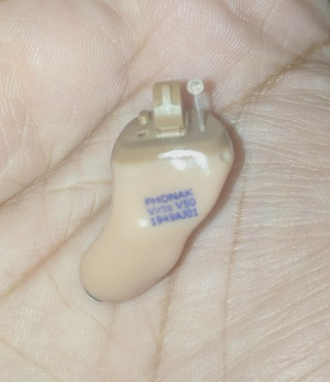 Hearing Loss